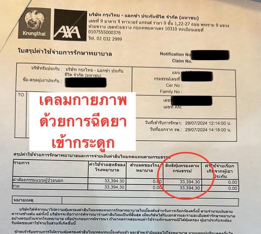 ทำกายภาพใครว่าถูกก ลูกค้าเคลมไป 33,394 บาท