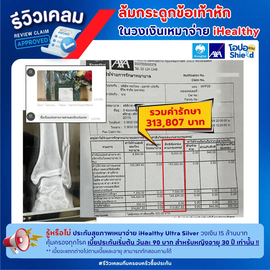 🚨2 ทุ่ม วันอาทิตย์ ล้มกระดูกข้อเท้าหัก แอดมิทด่วน !!