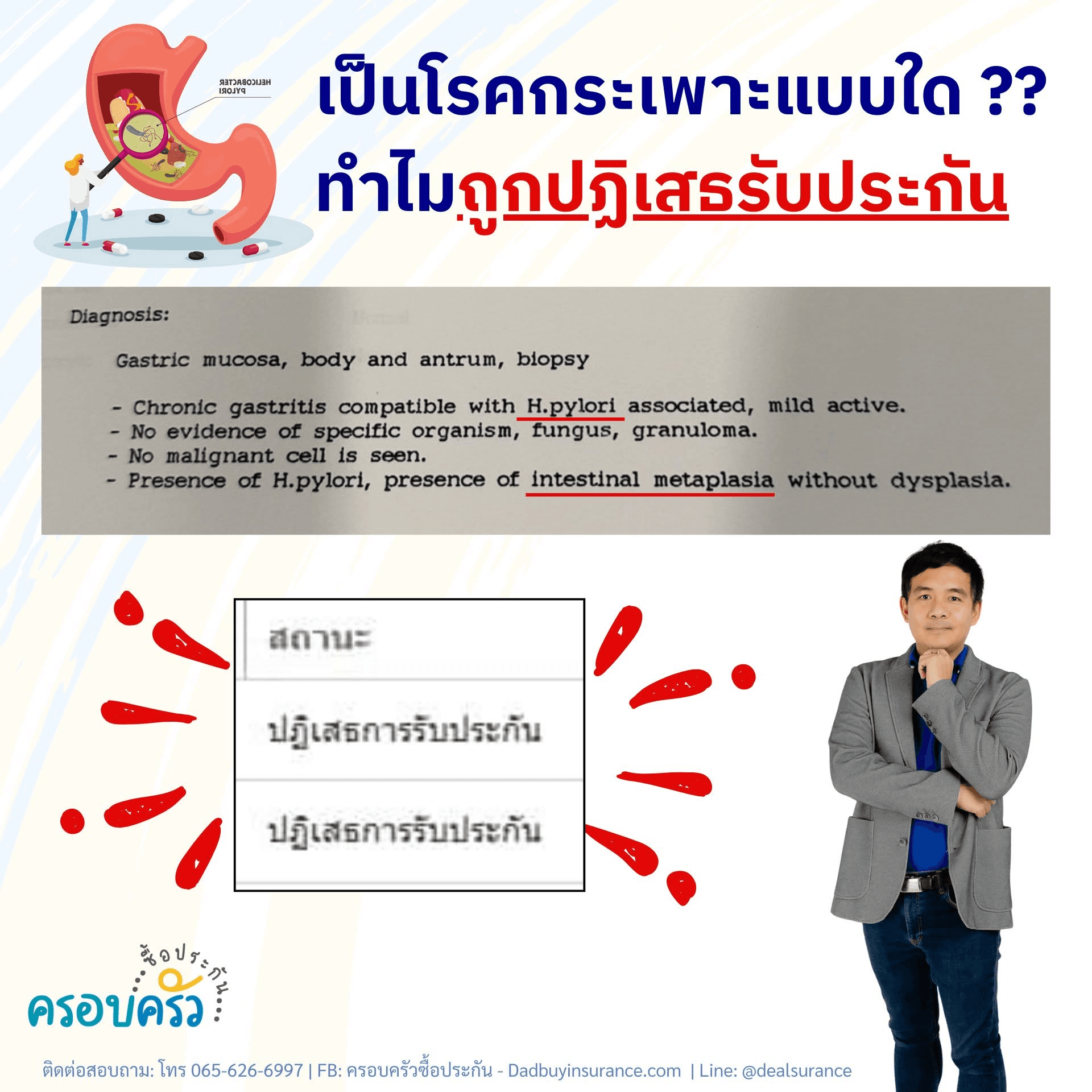 หญิงอายุ 34 ปี ทำประกันกลุ่มโรคร้ายแรง แนบประวัติโรคกระเพาะและถูกปฏิเสธรับประกันในเวลาต่อมา โรคกระเพาะ โรคง่ายๆ ทำไมถูก ปฏิเสธการรับประกัน ??